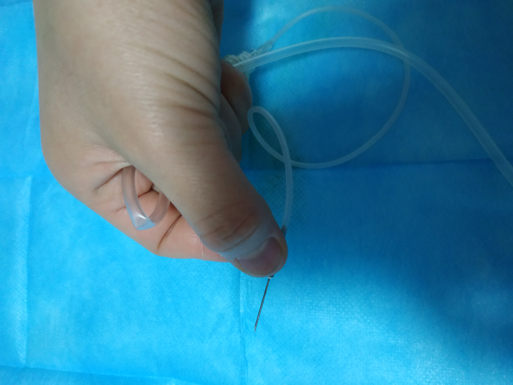 怎么调节输液器反折式负压静脉输液，包你成为一针大神，有图有真相_https://www.jmylbn.com_新闻资讯_第8张