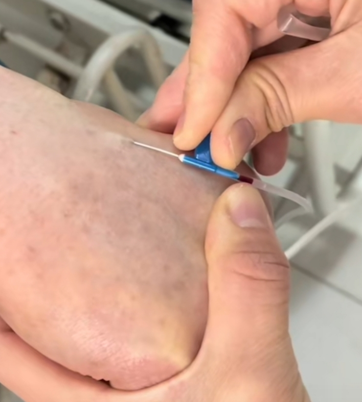 怎么调节输液器反折式负压静脉输液，包你成为一针大神，有图有真相_https://www.jmylbn.com_新闻资讯_第9张