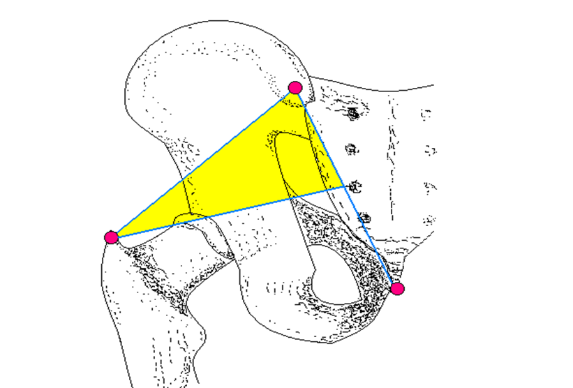 梨状肌的体表投影图片