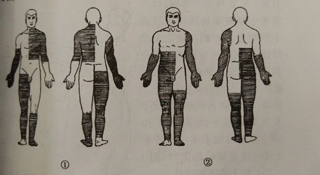 手术工具怎么消毒骨科手术消毒、铺巾操作，做好这几个细节事半功倍！_https://www.jmylbn.com_新闻资讯_第1张