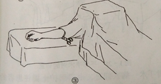 手术工具怎么消毒骨科手术消毒、铺巾操作，做好这几个细节事半功倍！_https://www.jmylbn.com_新闻资讯_第5张