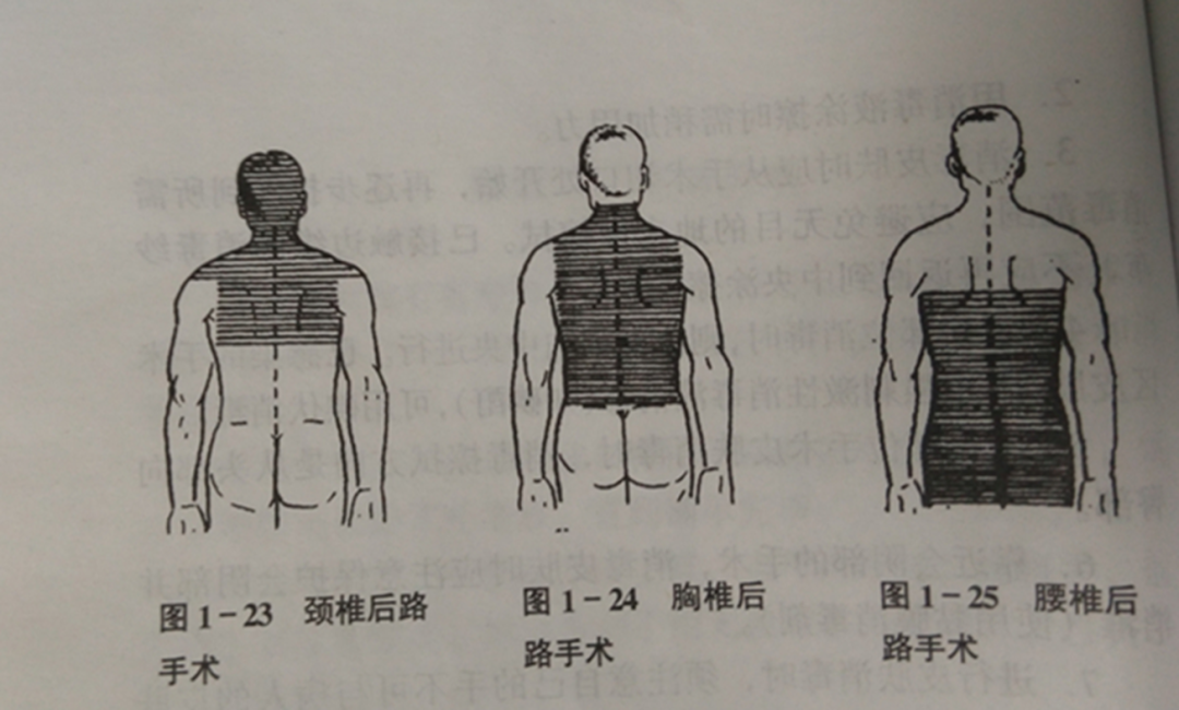 手术工具怎么消毒骨科手术消毒、铺巾操作，做好这几个细节事半功倍！_https://www.jmylbn.com_新闻资讯_第2张