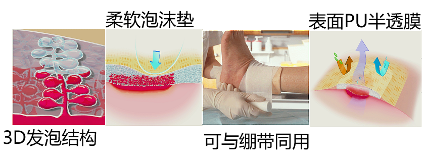 人工敷料怎么照顾伤口伤口分类及护理原则（五）：敷料的选择和选分类_https://www.jmylbn.com_新闻资讯_第9张
