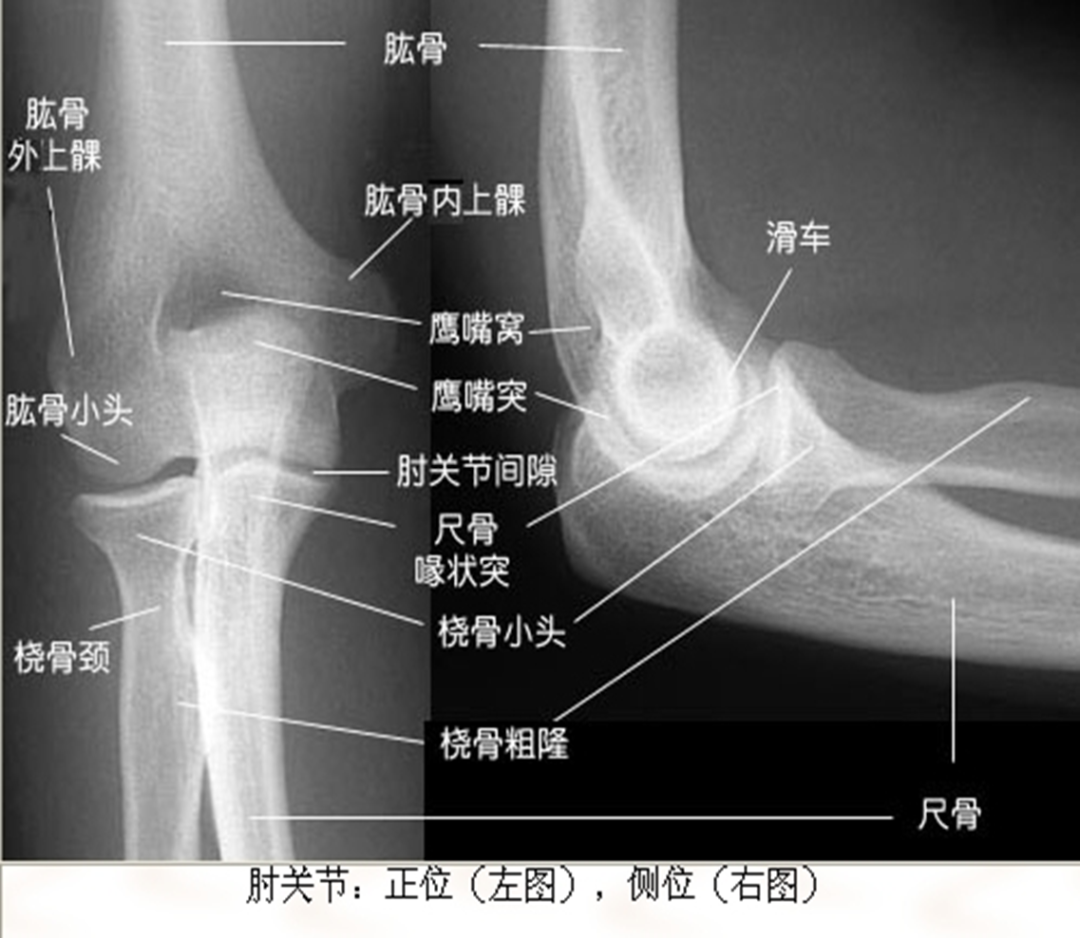 肘关节“恐怖三联征”最全攻略，让它不再“恐怖”！-德医学院-助力医学教育发展！