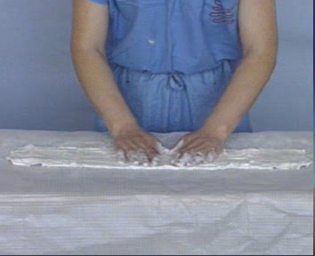 医用石膏夹板怎么软化关于骨折石膏固定技术总结及注意事项_https://www.jmylbn.com_新闻资讯_第5张