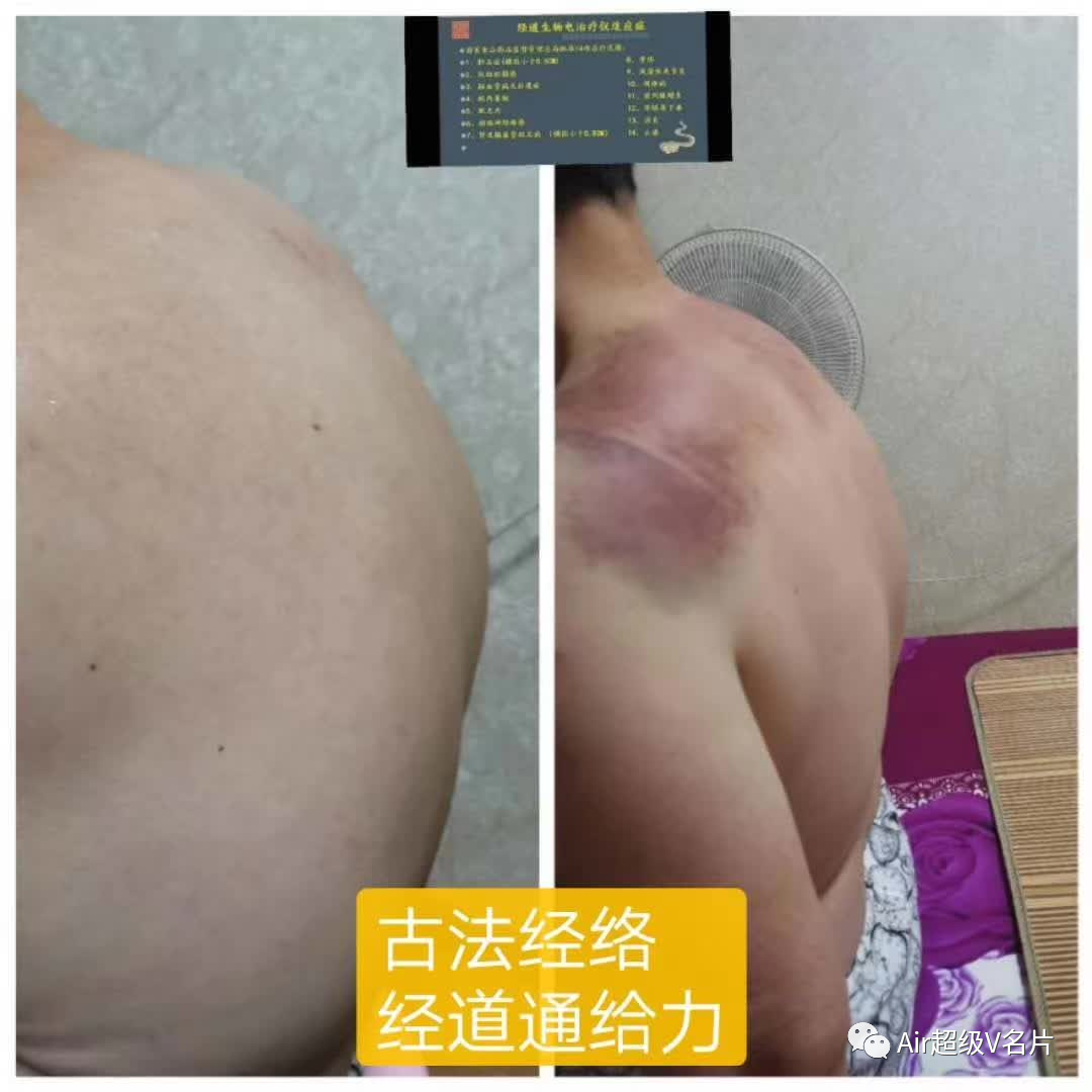 三伏期间，一定要做做背，清理一下身体中的垃圾，体内一通，一身