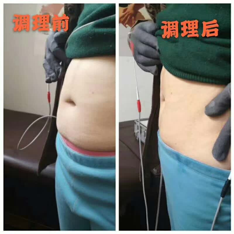 古法经络|为什么女人需要做肚子？‼️