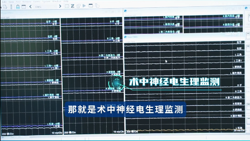 显微外科设备有哪些壹起揭秘手术室高科技：生命护航的秘密武器！_https://www.jmylbn.com_新闻资讯_第12张