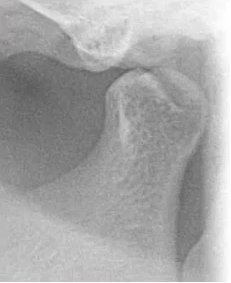 曲面断层片怎么看口腔精读 ｜ 一次性教你看懂曲面断层片！_https://www.jmylbn.com_新闻资讯_第42张