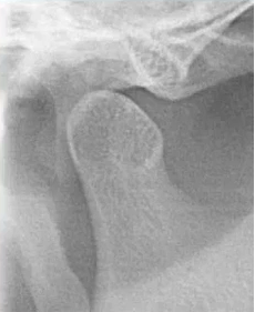 曲面断层片怎么看口腔精读 ｜ 一次性教你看懂曲面断层片！_https://www.jmylbn.com_新闻资讯_第41张