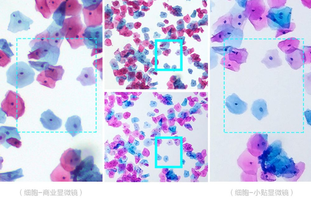 可貼在手機上的顯微鏡～400倍放大！蟎蟲都看得見！ 科技 第4張