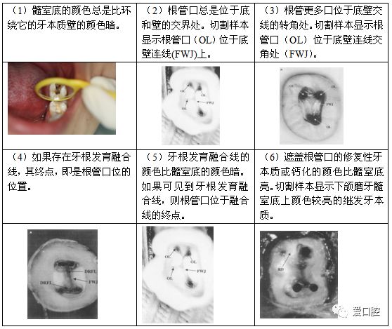根管治疗标准步骤和细节把握