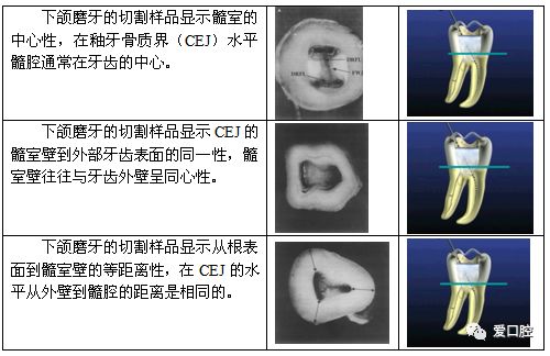 根管治疗标准步骤和细节把握