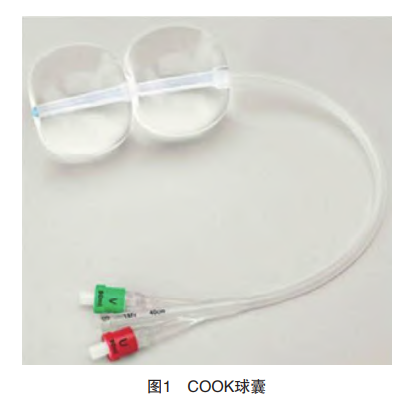 cook球囊怎么取COOK球囊联合催产素在瘢痕子宫足月妊娠引产中的应用_https://www.jmylbn.com_新闻资讯_第3张