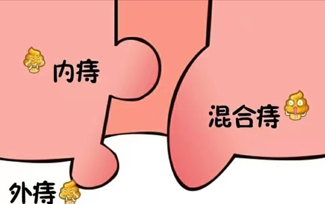 结肠水疗仪怎么操作“1-3=0”？肛肠专家回答：是的！_https://www.jmylbn.com_新闻资讯_第9张