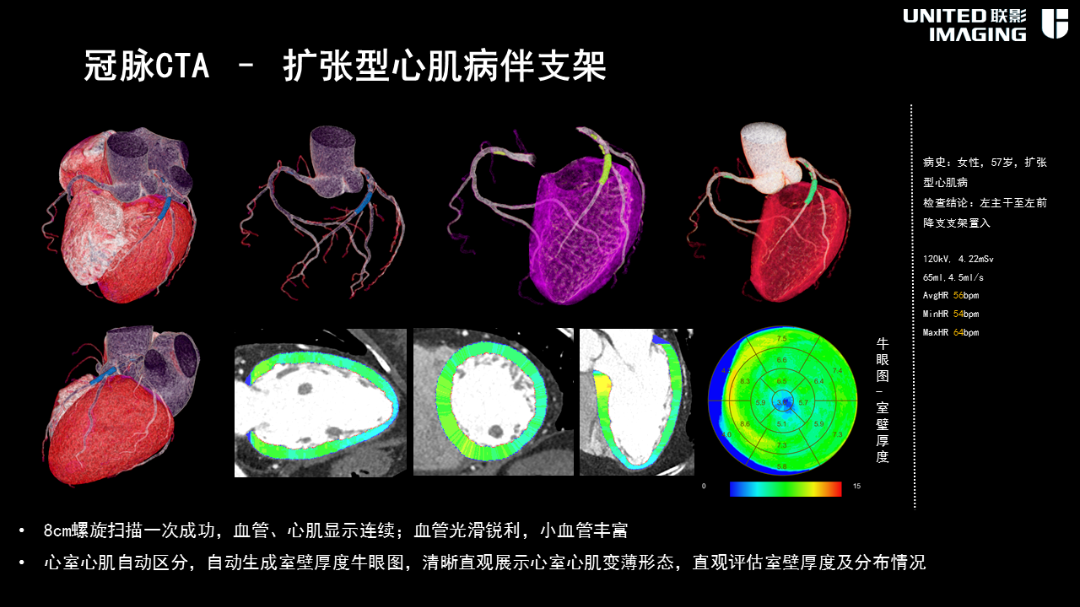 联影的CT怎么样造福剑川百姓，剑川县人民医院引进联影160排CT_https://www.jmylbn.com_新闻资讯_第15张