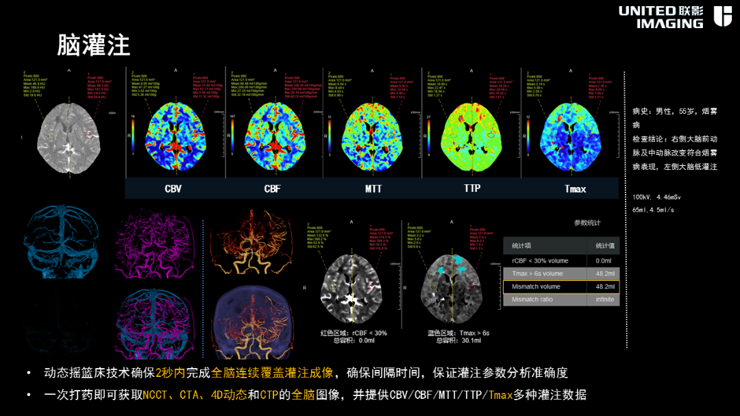 联影的CT怎么样造福剑川百姓，剑川县人民医院引进联影160排CT_https://www.jmylbn.com_新闻资讯_第24张