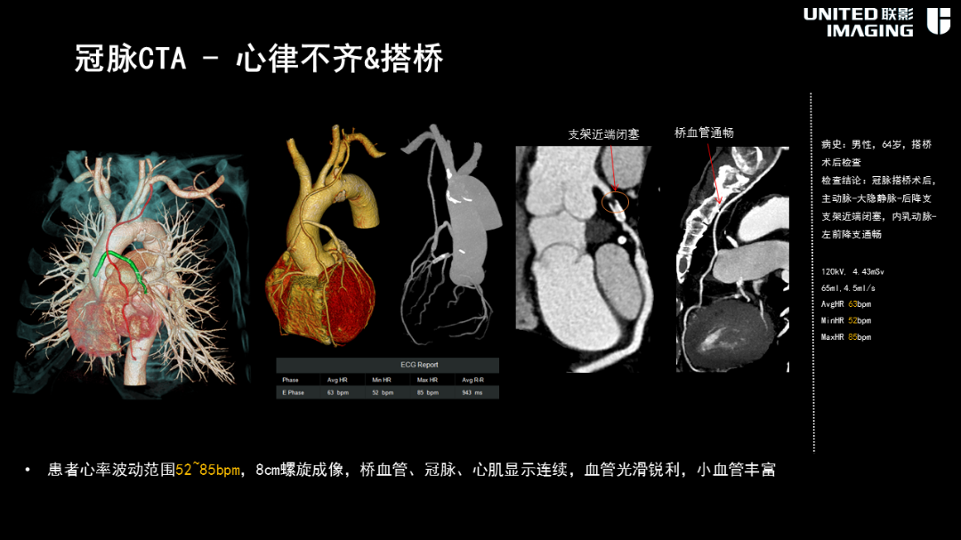 联影的CT怎么样造福剑川百姓，剑川县人民医院引进联影160排CT_https://www.jmylbn.com_新闻资讯_第16张