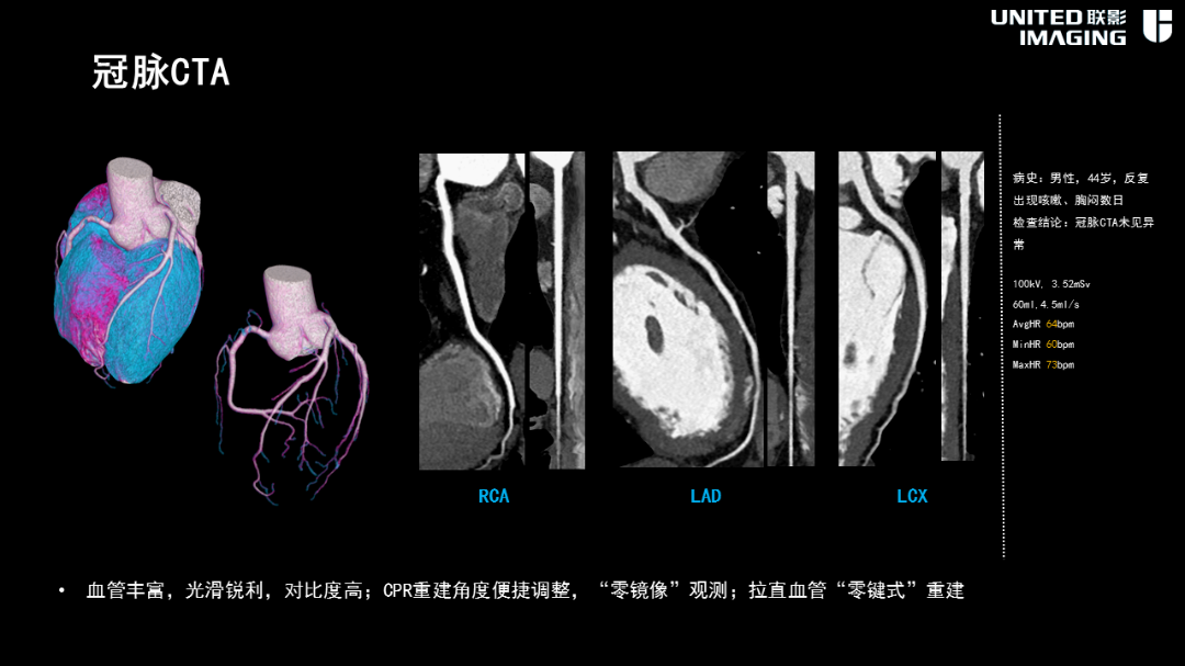 联影的CT怎么样造福剑川百姓，剑川县人民医院引进联影160排CT_https://www.jmylbn.com_新闻资讯_第9张