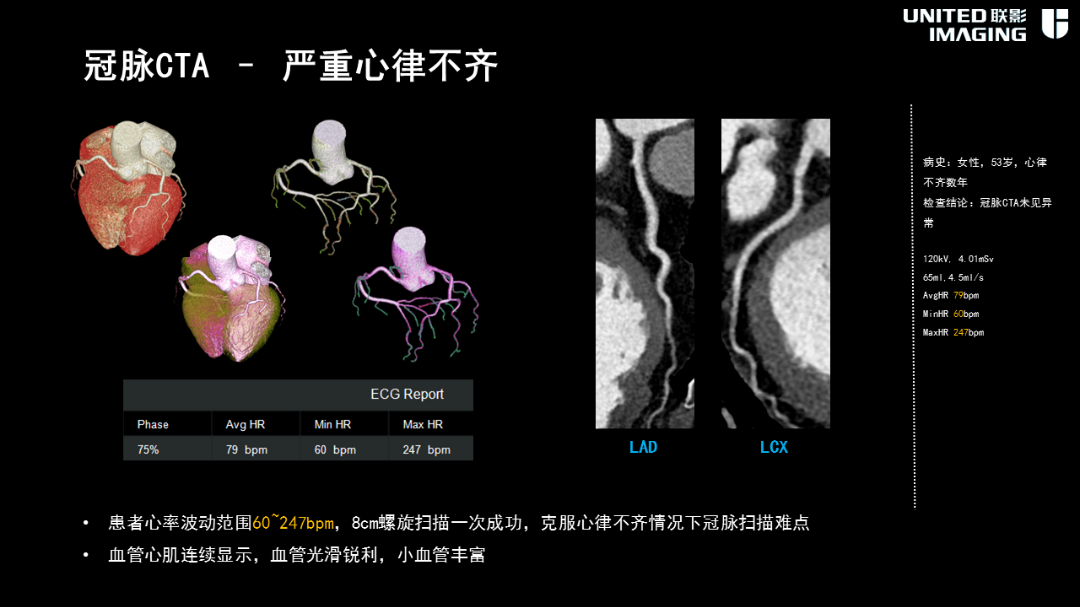 联影的CT怎么样造福剑川百姓，剑川县人民医院引进联影160排CT_https://www.jmylbn.com_新闻资讯_第13张
