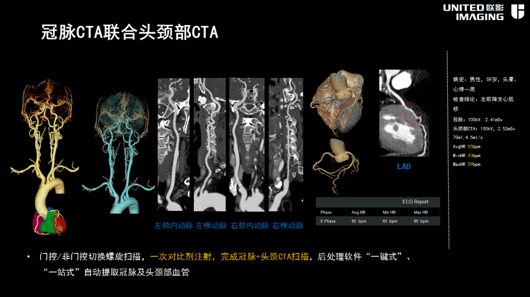 联影的CT怎么样造福剑川百姓，剑川县人民医院引进联影160排CT_https://www.jmylbn.com_新闻资讯_第19张