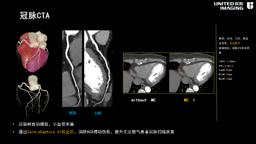 联影的CT怎么样造福剑川百姓，剑川县人民医院引进联影160排CT_https://www.jmylbn.com_新闻资讯_第11张