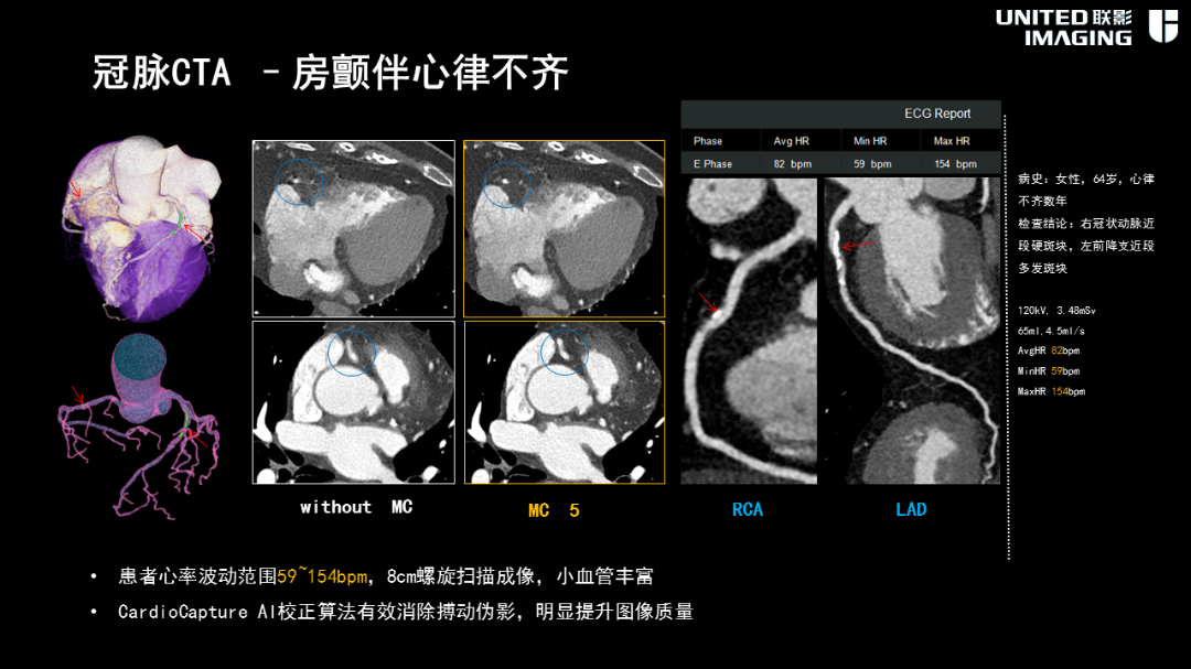 联影的CT怎么样造福剑川百姓，剑川县人民医院引进联影160排CT_https://www.jmylbn.com_新闻资讯_第14张