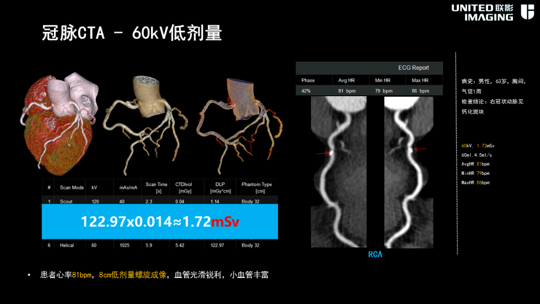 联影的CT怎么样造福剑川百姓，剑川县人民医院引进联影160排CT_https://www.jmylbn.com_新闻资讯_第17张