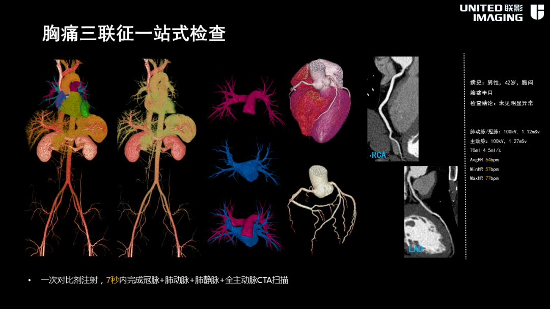 联影的CT怎么样造福剑川百姓，剑川县人民医院引进联影160排CT_https://www.jmylbn.com_新闻资讯_第21张