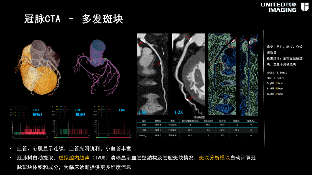 联影的CT怎么样造福剑川百姓，剑川县人民医院引进联影160排CT_https://www.jmylbn.com_新闻资讯_第10张