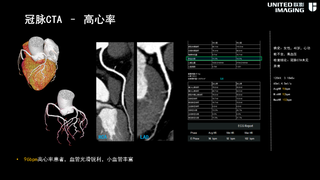 联影的CT怎么样造福剑川百姓，剑川县人民医院引进联影160排CT_https://www.jmylbn.com_新闻资讯_第12张