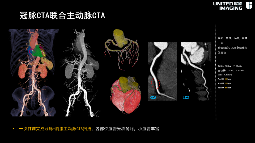 联影的CT怎么样造福剑川百姓，剑川县人民医院引进联影160排CT_https://www.jmylbn.com_新闻资讯_第20张