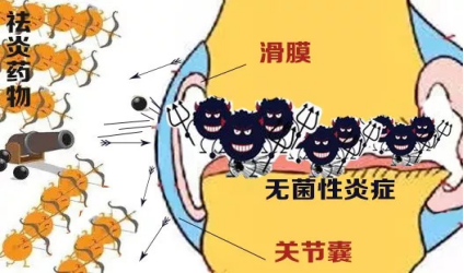 抗炎止痛良药非甾体抗炎药