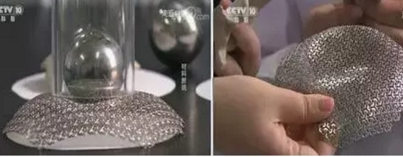 【科技前沿】3D打印钛合金人体骨骼，原来“换骨”术早就有了的图4