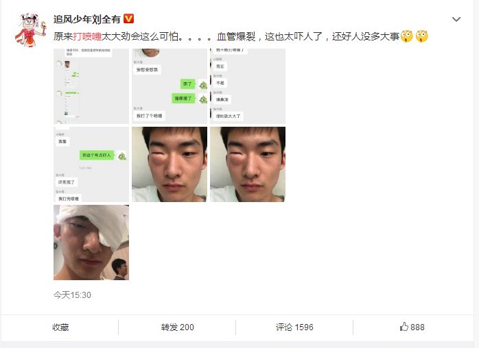 小喷嚏，大危害！有人因喷嚏血管爆裂，还有人因此搭上生命...