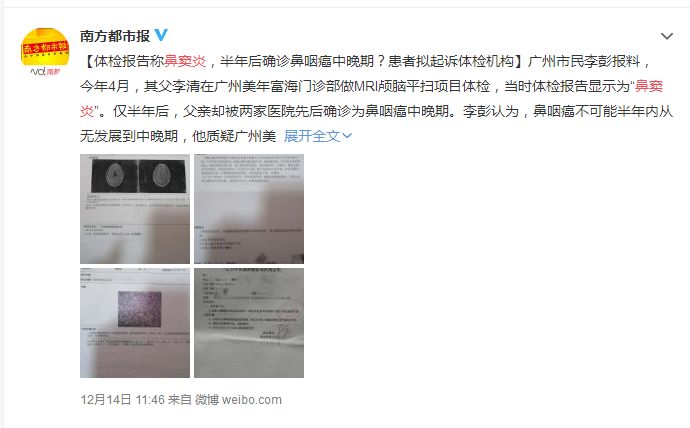 半年内从鼻窦炎“变成”鼻咽癌？有鼻窦炎的一定要看完！