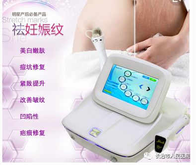 多极射频是什么多级射频治疗妊娠纹，产后妈妈的美丽新武器_https://www.jmylbn.com_新闻资讯_第5张