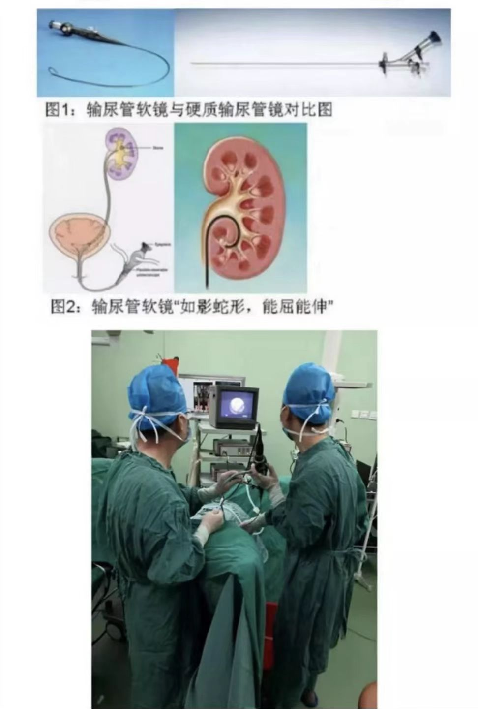 什么是输尿管镜【器械介绍】电子输尿管软镜_https://www.jmylbn.com_新闻资讯_第3张