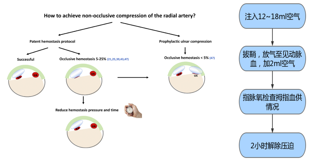 桡动脉鞘怎么读R.A.V.I.Club微课堂 · 经桡动脉外周介入之复旦中山篇第十一期_https://www.jmylbn.com_新闻资讯_第13张