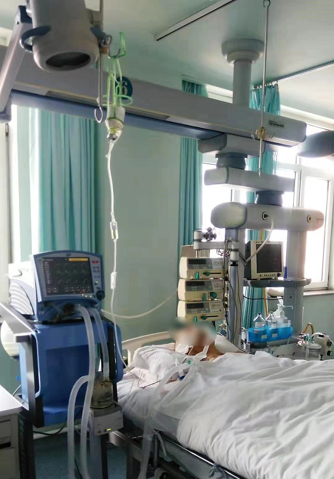 什么是有创呼吸机图片杏林百科 ｜ 五分钟带你了解ICU里的呼吸机_https://www.jmylbn.com_新闻资讯_第2张