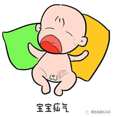 小儿疝气医学上称小儿腹股沟斜疝,是小儿最常见的外科疾病.