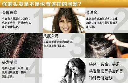 头皮的亚健康问题，你有吗？
