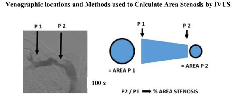 医学上ipc是什么米国静脉论坛上肢深静脉血栓临床指南与深度解析_https://www.jmylbn.com_新闻资讯_第16张
