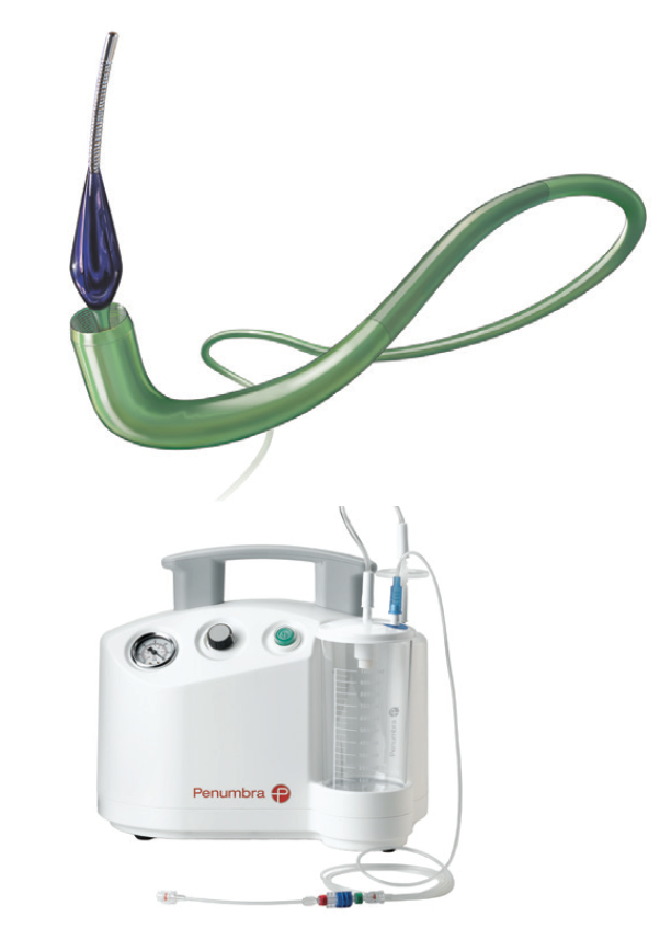 医学上ipc是什么米国静脉论坛上肢深静脉血栓临床指南与深度解析_https://www.jmylbn.com_新闻资讯_第23张