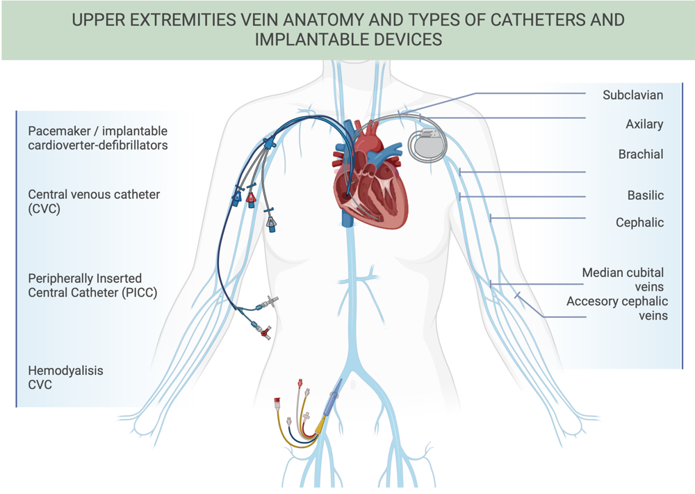 医学上ipc是什么米国静脉论坛上肢深静脉血栓临床指南与深度解析_https://www.jmylbn.com_新闻资讯_第6张