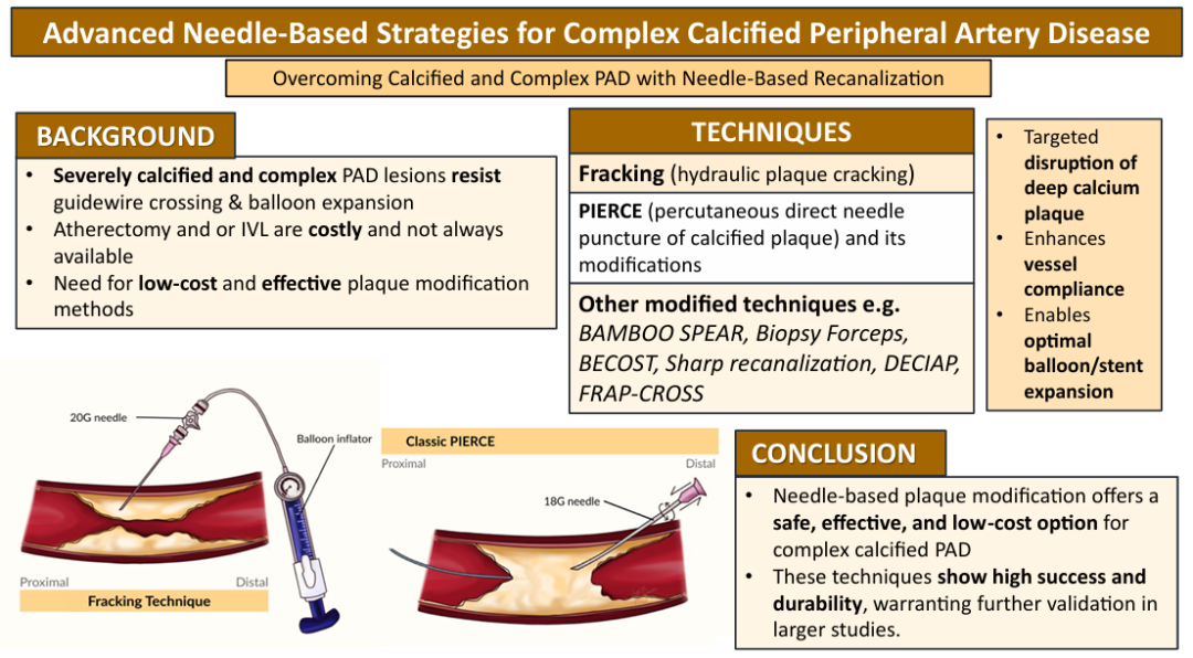 动脉钳怎么用动脉重度钙化导丝无法通过 针具技术超补救策略_https://www.jmylbn.com_新闻资讯_第10张