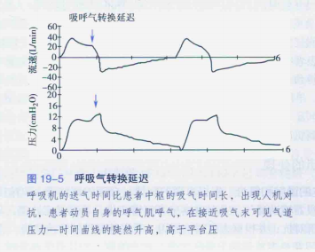 为什么呼吸机人机同步人机不同步与呼吸机波形分析，处理方式如下_https://www.jmylbn.com_新闻资讯_第6张