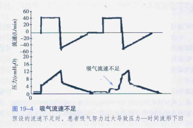 为什么呼吸机人机同步人机不同步与呼吸机波形分析，处理方式如下_https://www.jmylbn.com_新闻资讯_第5张