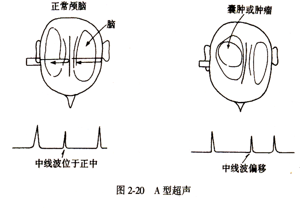 b超伪彩什么B超和彩超有什么区别？-上海聚慕医疗器械有限公司