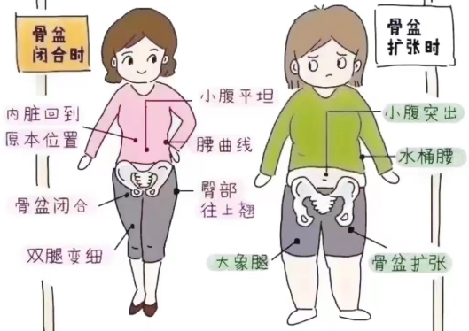 产后怎么康复治疗【产后康复】“手法+气压”骨盆修复，唤醒女性自然之美_https://www.jmylbn.com_新闻资讯_第3张